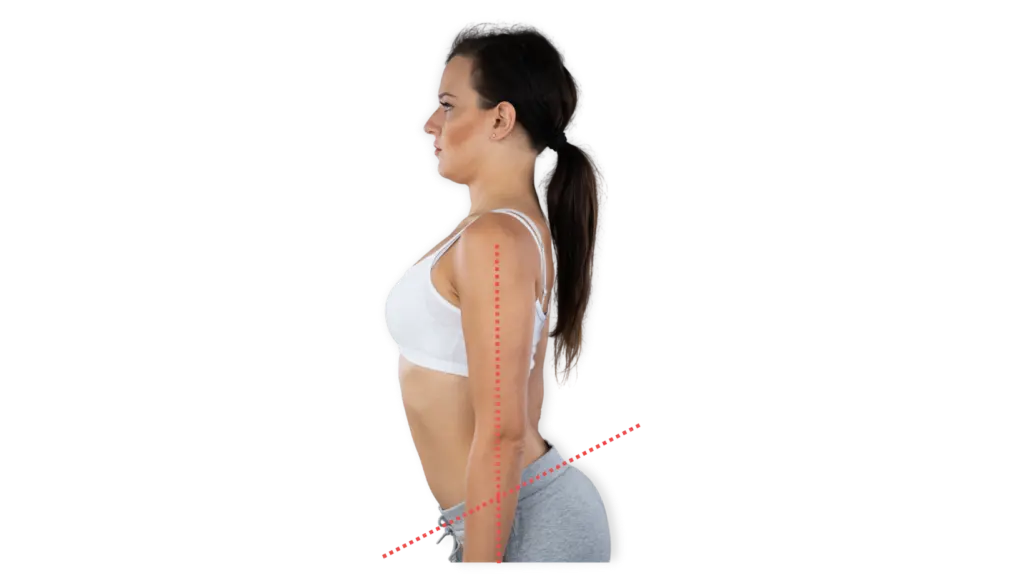 How To Fix Lordosis at Home